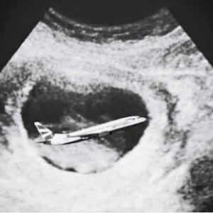 Meet your Posher, Tonny